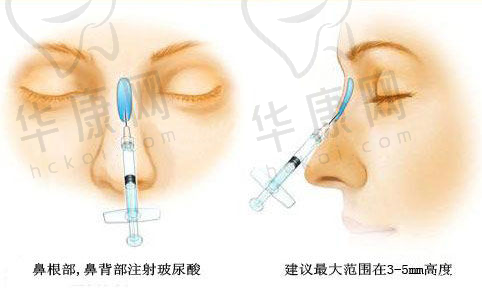 北京美雅枫医院张立彬万元起价背后有何成本逻辑？