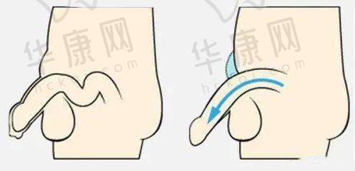 曹其帅医生的专精实力