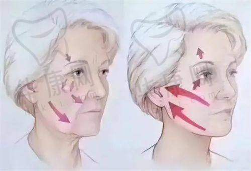 东莞东城爱思特医疗美容魏鑫铭脂肪填充之手术体验