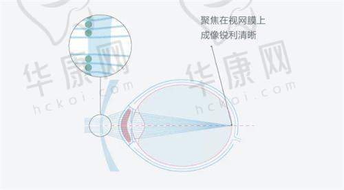 太原爱维视眼科门诊部患者评价