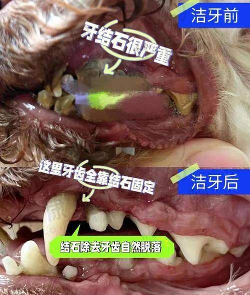 合肥佳德庐阳口腔舒适化喷砂洁牙的其他优势