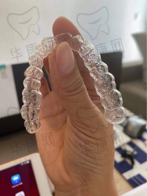 唐山壹颗芽口腔隐适美隐形矫正的成功实例