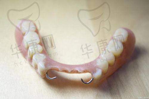 东莞好佰年口腔全口吸附性义齿的患者口碑
