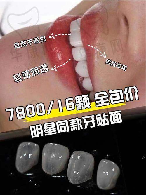 唐山壹颗芽口腔E-MAX全瓷贴面患者评价与口碑