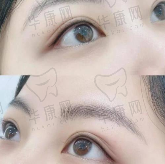 大理伊美东方丽人整形的医院实力能说明正规吗？
