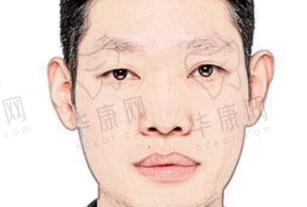 单兴柱