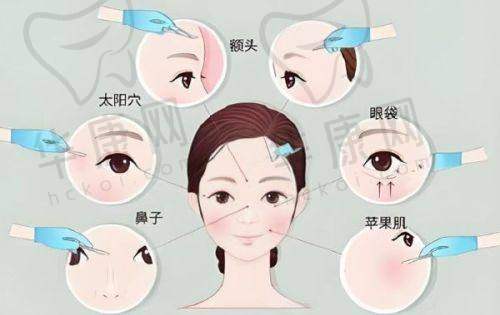 厦门欧菲整形吸脂怎么样？技术优价格惠，实例见证塑造完美体态超靠谱