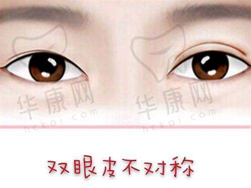 厦门欧菲医疗美容医院袁纯新内窥镜双平面复合丰胸49750元起，打造自然饱满美胸！