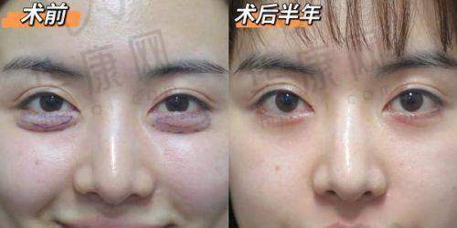 东莞东城紫芯医疗美容袁道红预约方式