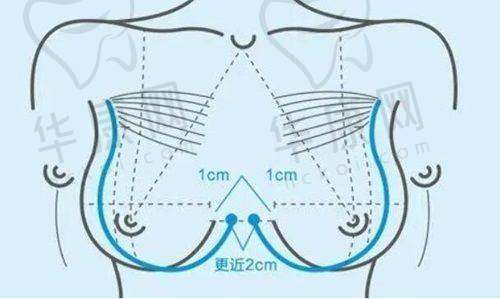 青岛城阳区诺美德医疗美容朗继春吸脂失败后的检查