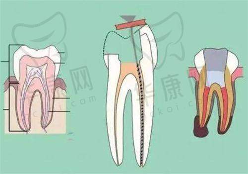 常熟安澜隆盈口腔前牙显微根管治疗1480元起，高端设备与专业团队护航！