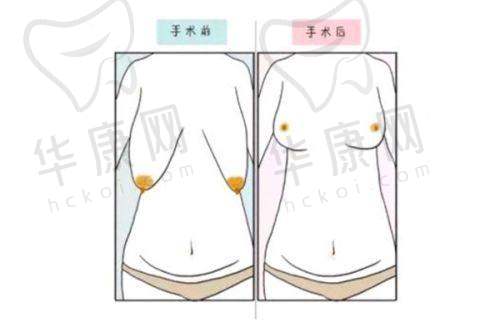 武汉韩辰整形的收费价格与服务质量