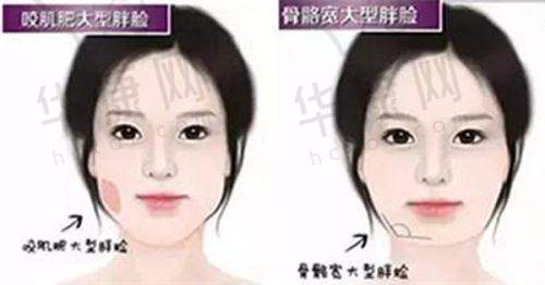 合肥吴氏佳美医疗美容门诊部正规吗？