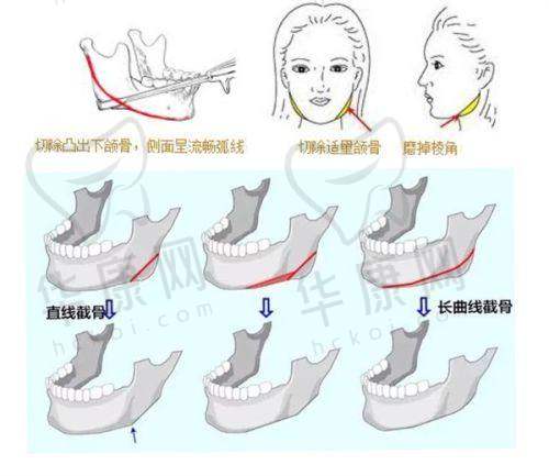 嘉兴韩辰医疗美容医院口碑怎么样？多领域优势凸显，获众多求美者高度认可！