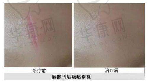 七、宁波鄞州艺星时代美容医院真实的患者评价如下：