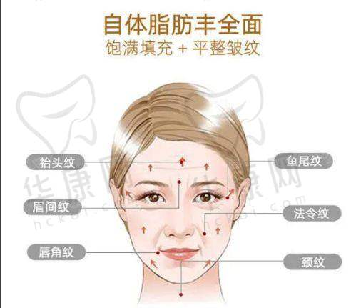 淮安华美整形外科王锐上睑下垂矫正的口碑与评价