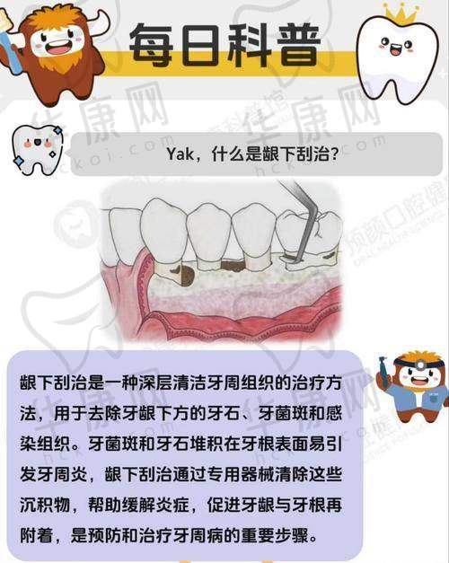 常熟安澜隆盈口腔医生在半口龈下刮治方面的优势