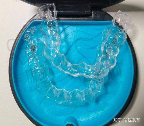 南通美特美口腔隐适美隐形矫正的适合人群