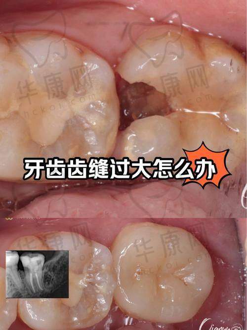 哈尔滨中航口腔根管治疗仅580元起，正规私立医院收费透明超划算