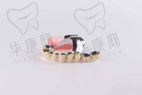 哈尔滨中航口腔医生在德国迪瑞全瓷冠项目上的优势