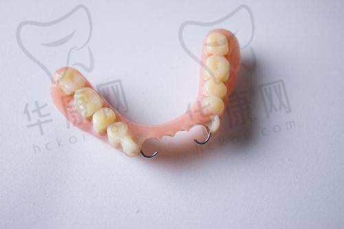 清远清城中泰口腔半口活动义齿的服务特色