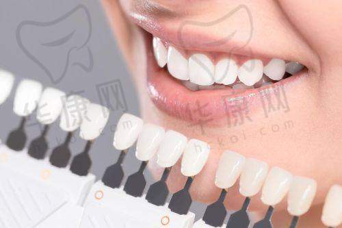 常熟安澜隆盈口腔爱尔创全瓷贴面成功实例
