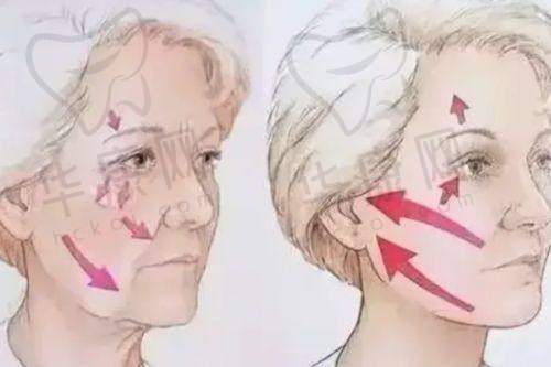 武汉仁爱时光医疗美容医院包涛双C动感丰胸之整体感受