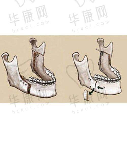义乌秀壹医疗美容李龙馒化修复之术前准备