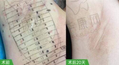 重庆十大医美整形医院排名如何，院内医生和诊疗项目特色全知晓