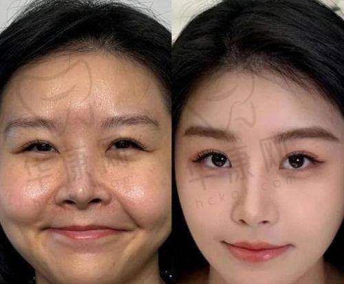北京画美医院是正规医院吗？——设备与卫生保护