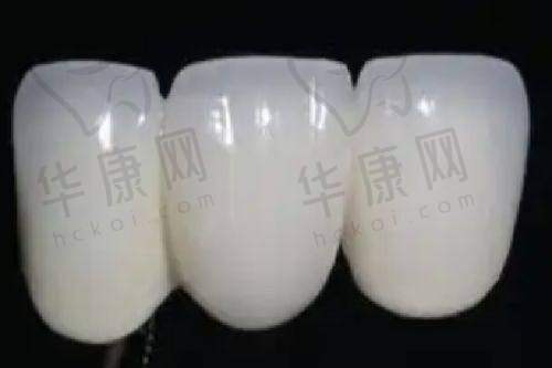 兰州诺贝尔口腔医院的价格合理性