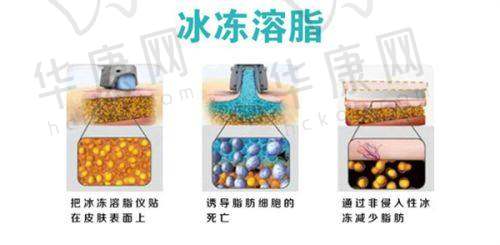 上海华美医疗美容医院，怎样成为上海玻尿酸填充的安心保护？