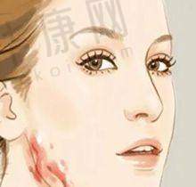 宜宾丝缘植发医疗美容发际线种植的客户评价