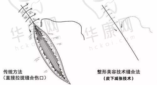 保定华美整形美容医院有哪些特色服务与项目？