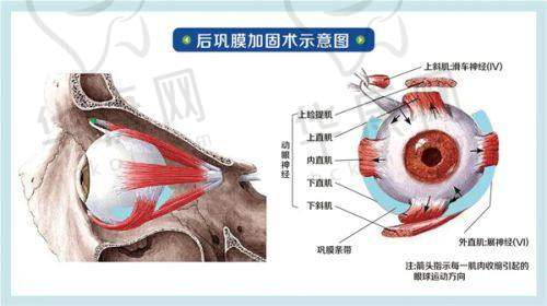 骨干医生团队保护昆明艾维眼科医院斜视手术质量