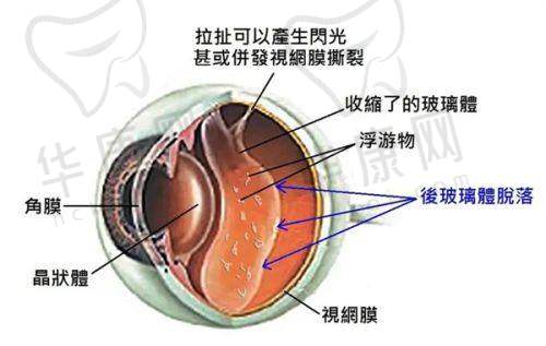 南宁爱尔眼科医院近视手术患者评价如何？