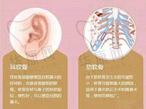 杨胜发医生在M+至臻生态美眼术方面的特色优势