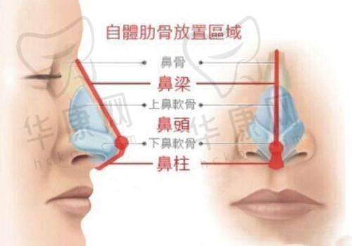 长春净月悦美汇医疗美容尹慧玲吸脂的用户口碑