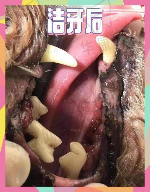 廊坊爱嘉口腔医生在超声波洁牙上的技术优势