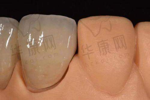常熟明日口腔医生团队在全口活动义齿项目的优势