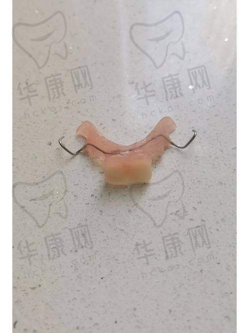 常熟明日口腔全口活动义齿的服务保护