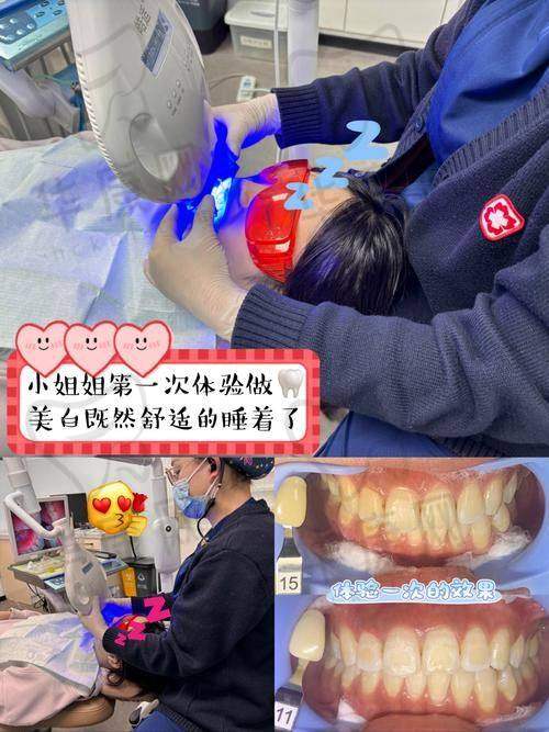 兰州诺贝尔口腔皓齿美白的服务优势