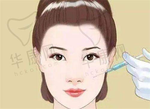 上海星璨李海涛筋膜大拉皮怎样打造饱满“少女感”？