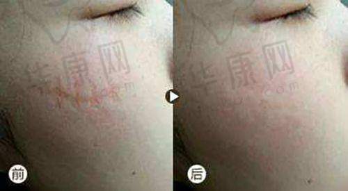 如何进行余文林耳朵再造唇裂修复预约挂号?