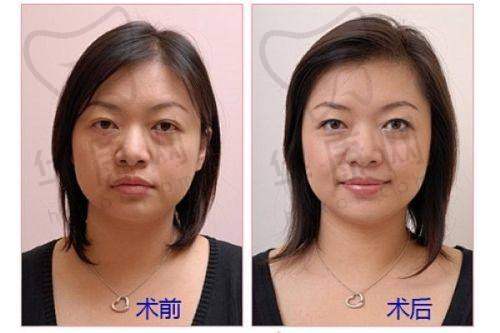 西 南医院美容整形科有哪些非凡医生？