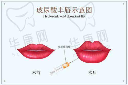 上海还有哪些值得关注的眼睛修复医生？