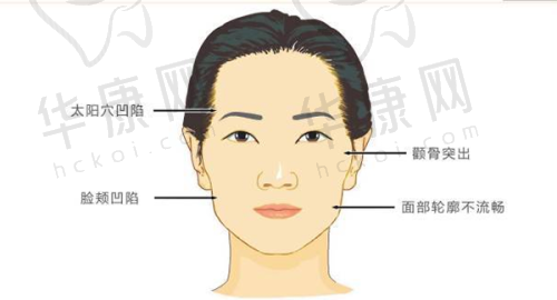 10万元找刘志刚做高难度眼修复值不值？