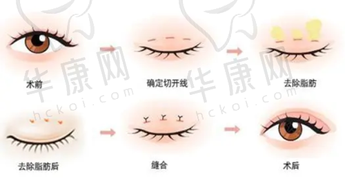 刘亚平医生擅长项目