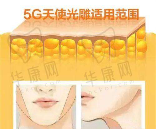 上海星璨李海涛筋膜大拉皮如何做到疤痕不明显？