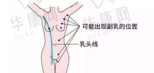 西 南医院美容整形科隆鼻实例成效如何？